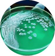 Bacterial cultures growing in a petri dish for microbiology research