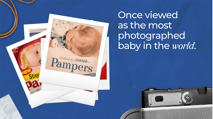 Once viewed as the most photographed baby in the world.