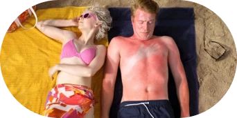 Sunburnt man and woman at the beach.