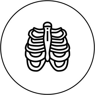 Rib fractures