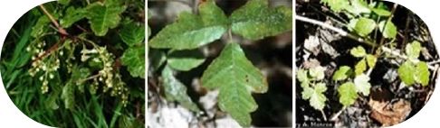 Poison Ivy, Oak, and Sumac Rashes: Symptoms and Treatments - Image 3 - Benadryl - en-US
