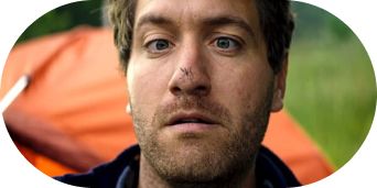 Startled man with a mosquito landed on his nose.