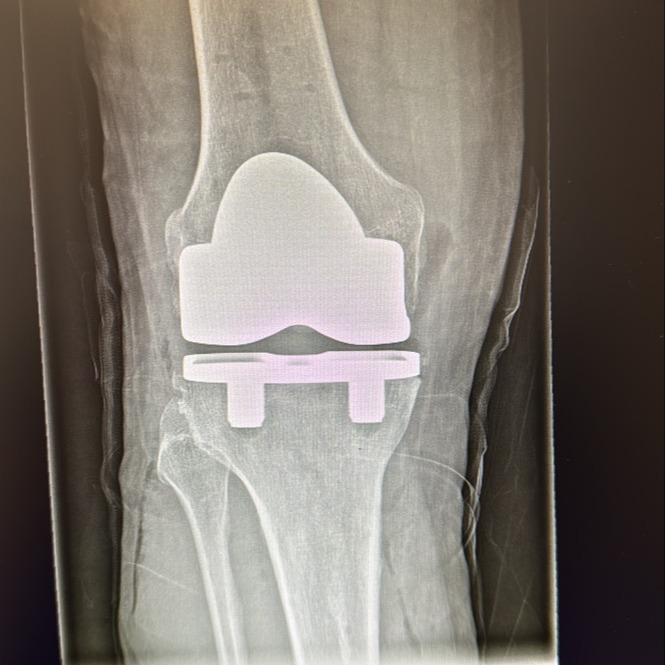 blog-post-image