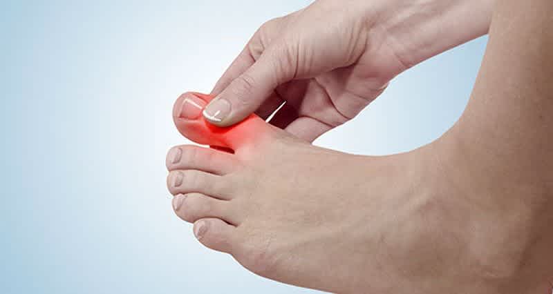 toe-pain