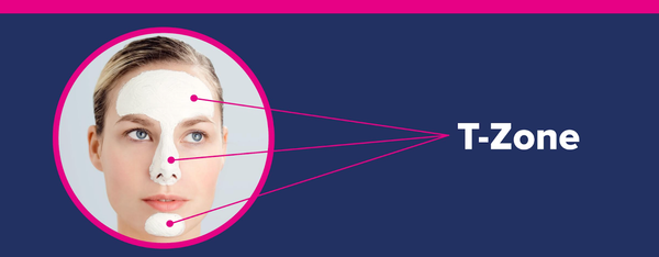 What Causes Oily Skin