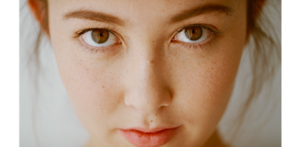 acne-prone_skin_treatment_and_skin_care-1_IMG