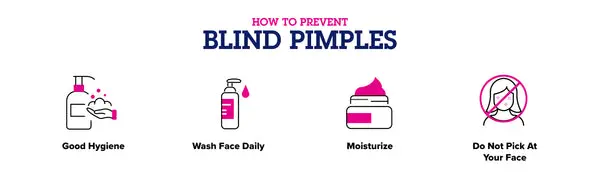how-to-prevent-blind-pimples 600x600