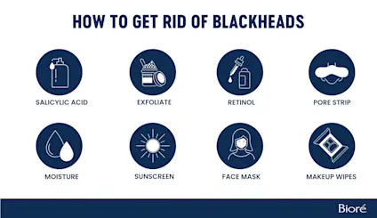 how-to-get-rid-of-blackheads