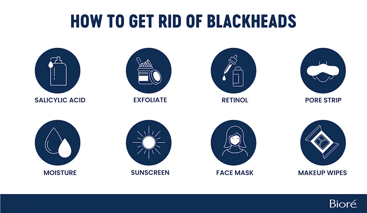 how-to-get-rid-of-blackheads
