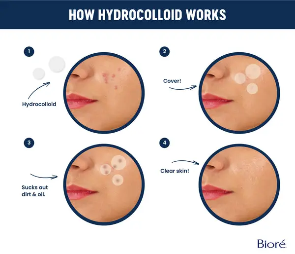 how hidrocolloid words