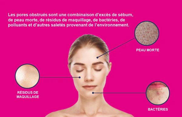 CloggedPores-FRversionofimage 600x600