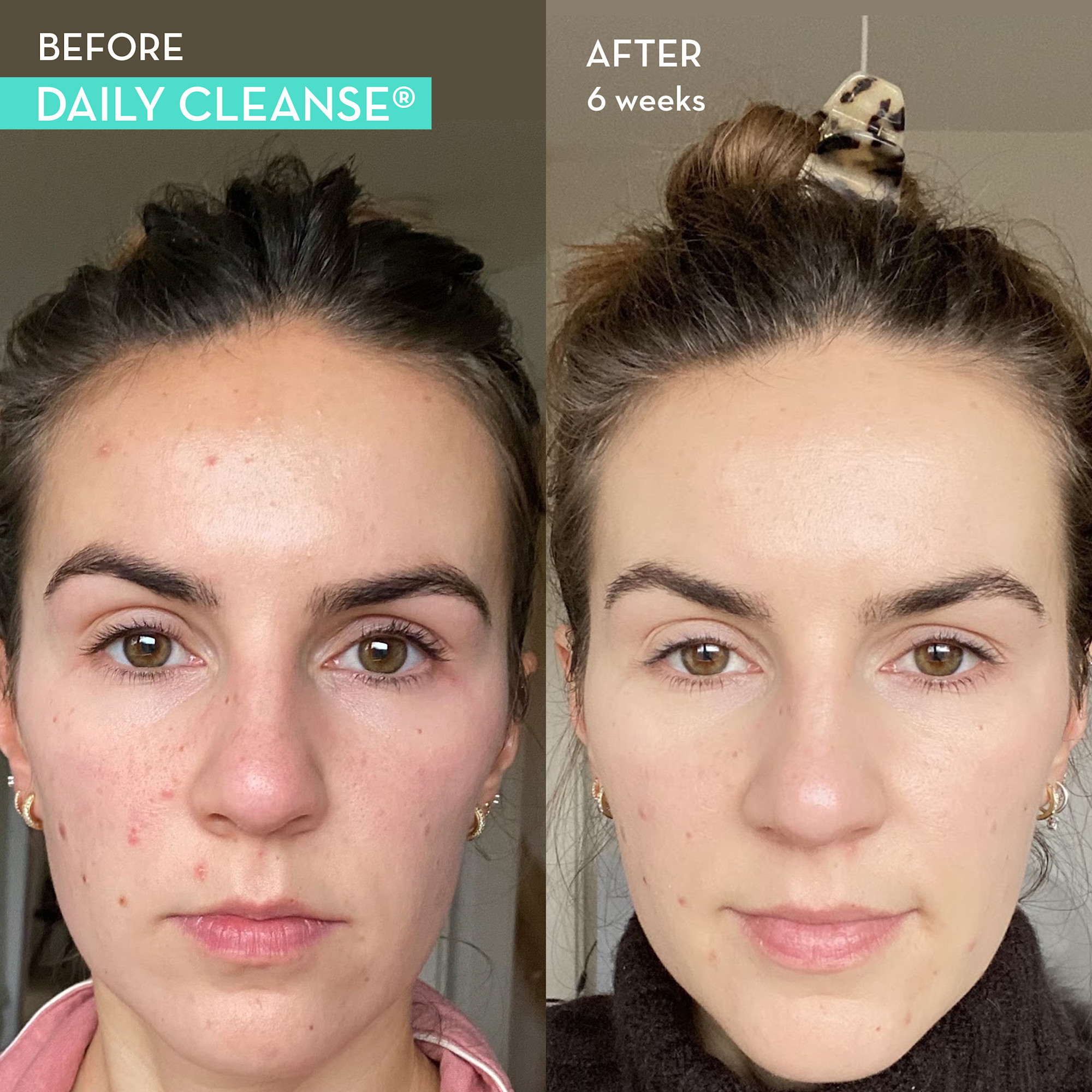 Pre Cleanse Routine Daily Cleanse | Best Detox Supplement for Clear Skin - HUM Nutrition