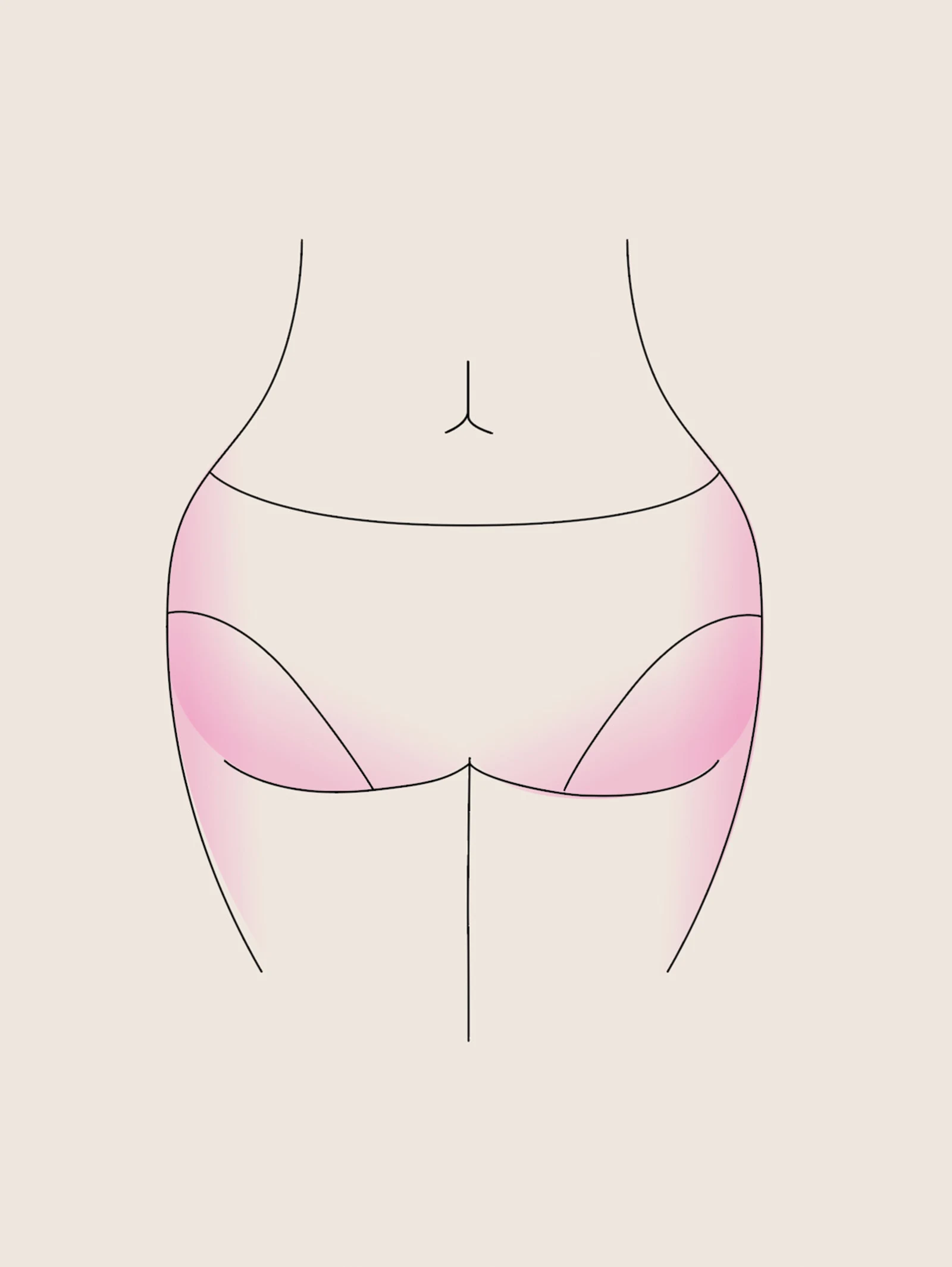 Illustration einer weiblichen Körpermitte mit Fokus auf Hüfte und Gesäß, betont durch pinkfarbene Schattierungen. Illustration einer weiblichen Körpermitte mit Fokus auf Hüfte und Gesäß, betont durch pinkfarbene Schattierungen.