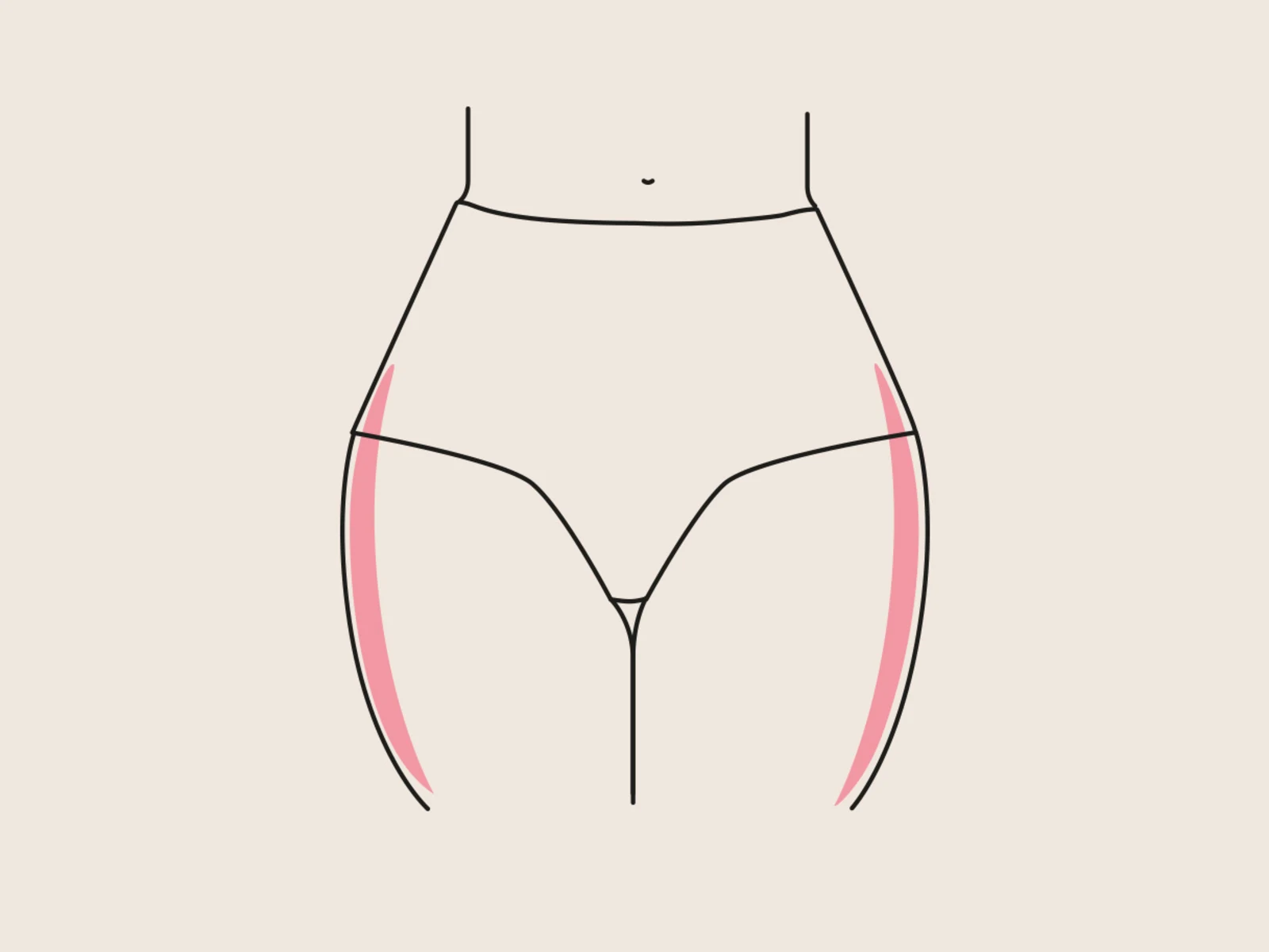 Illustration einer weiblichen Körpermitte in Unterwäsche, mit rosa Markierungen an den Außenseiten der Oberschenkel. Illustration einer weiblichen Körpermitte in Unterwäsche, mit rosa Markierungen an den Außenseiten der Oberschenkel.