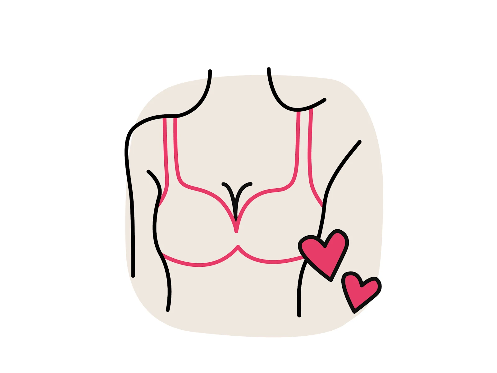 Illustration eines Dekolletés mit BH: Die Konturen der Brust sind mit roten Linien hervorgehoben. Zwei kleine Herzen.
