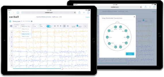 Grio designed and built the first of its kind medical IoT clinician web portal for Ceribell