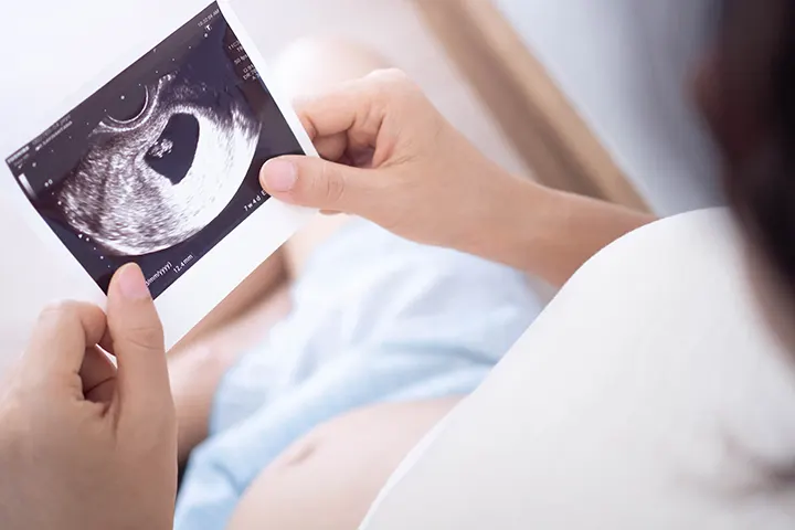 Τα πρώτα σημάδια της εγκυμοσύνης και πώς θα τα αναγνωρίσεις