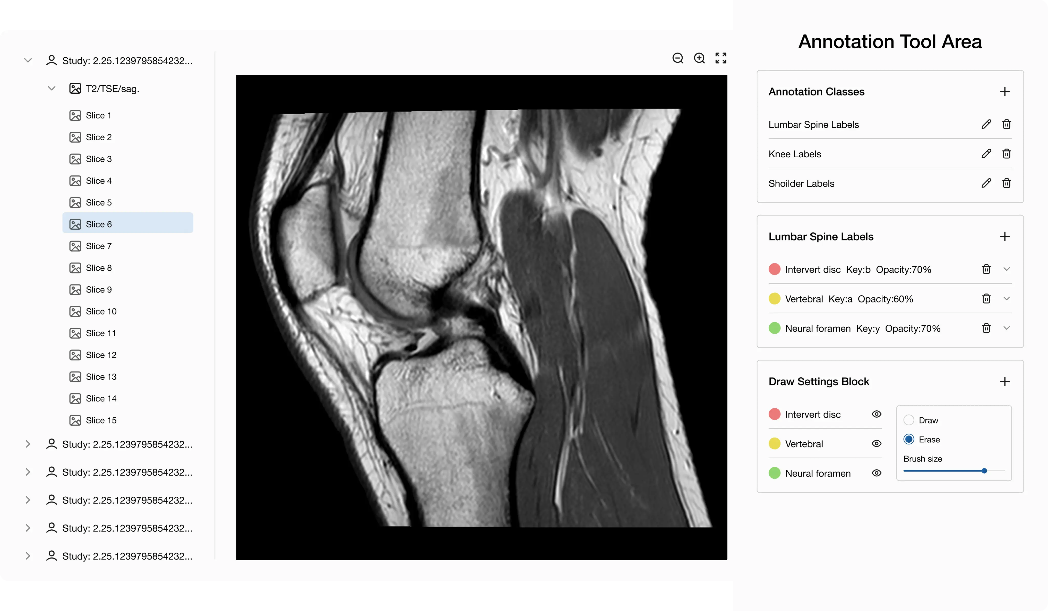 YWS > Works > CaseStudy > Balzano > Key features > Annotation tool area