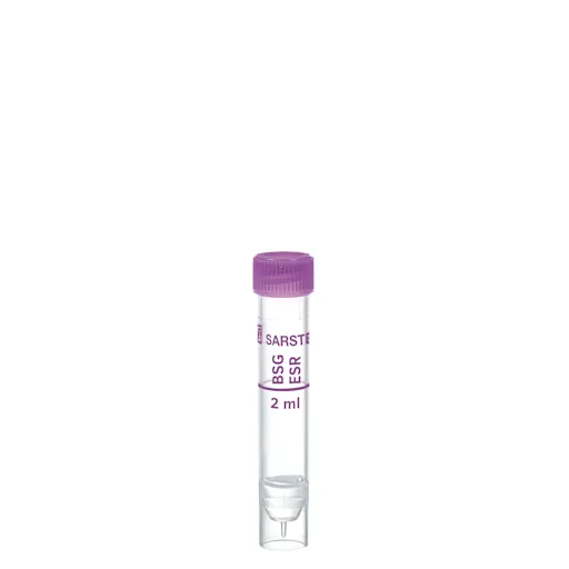 Tubes préparés avec bouchon à vis et fond plat