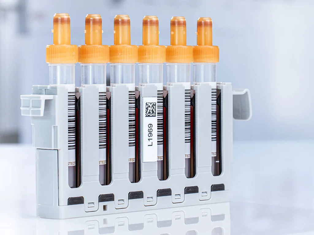 RS307450 SARSTEDT HALLO DIGITAL 251 retuschiert-hpr zugeschnitten