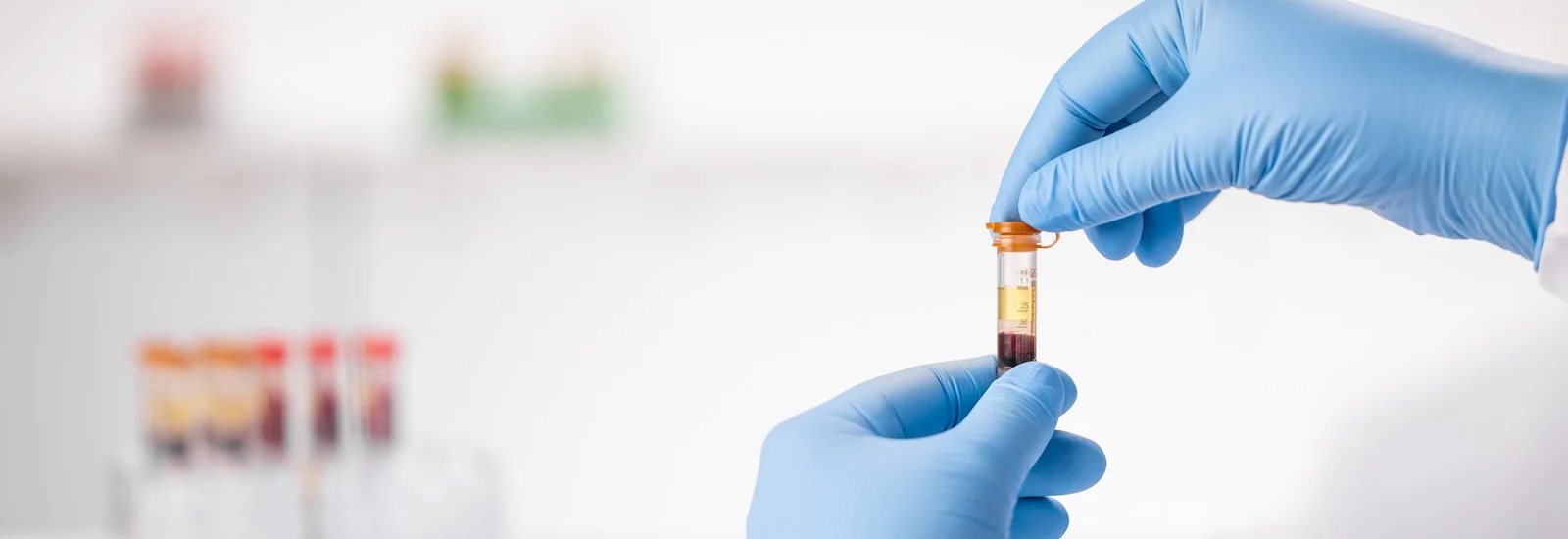 Prepared micro test tubes | SARSTEDT
