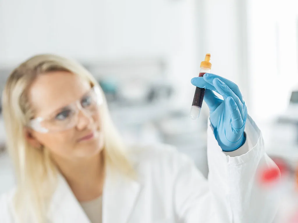 RS311412 SAR BloodSampling-1024x768