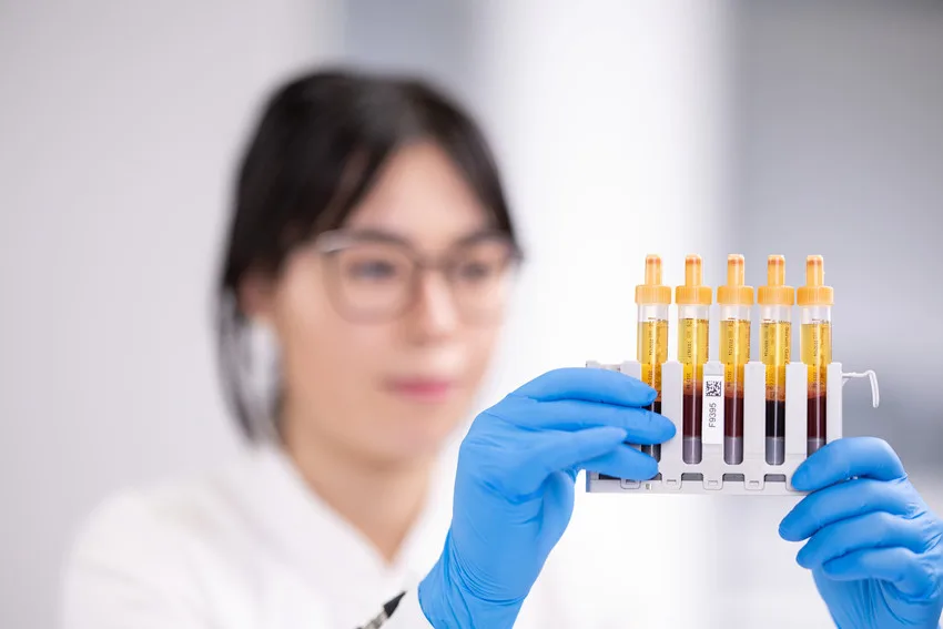 Bild S-Monovette Probengewinnung