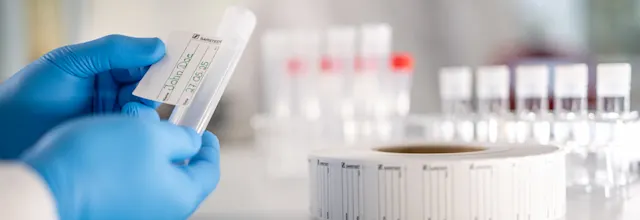 Adhesive labels for the laboratory | SARSTEDT