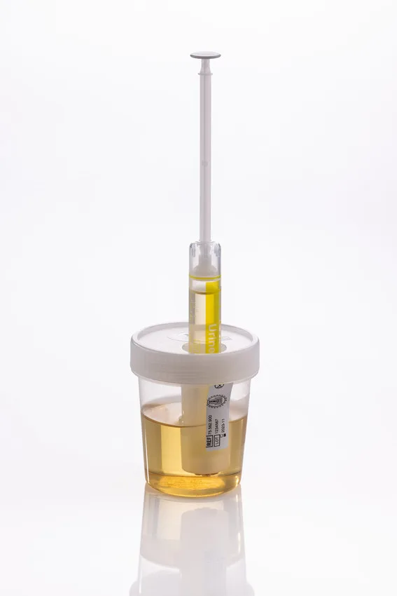 NFT urine products