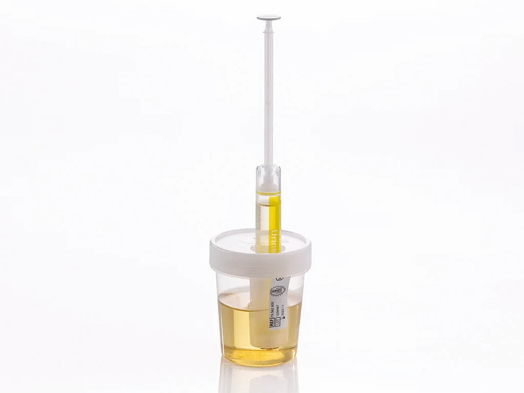 NFT urine products