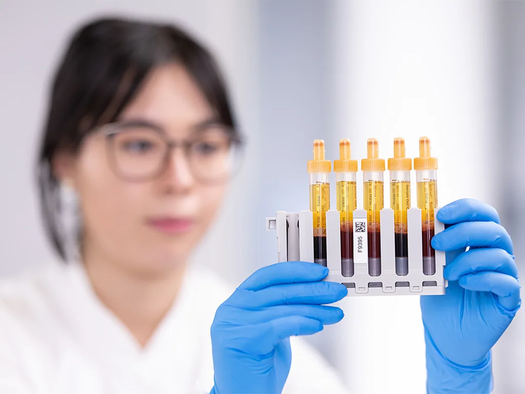 USE ProbengewinnungRS283523 1024x768