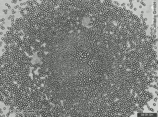 USE - LS - BIOFLOAT - Landingpage Platzhalter Use Case 320 210