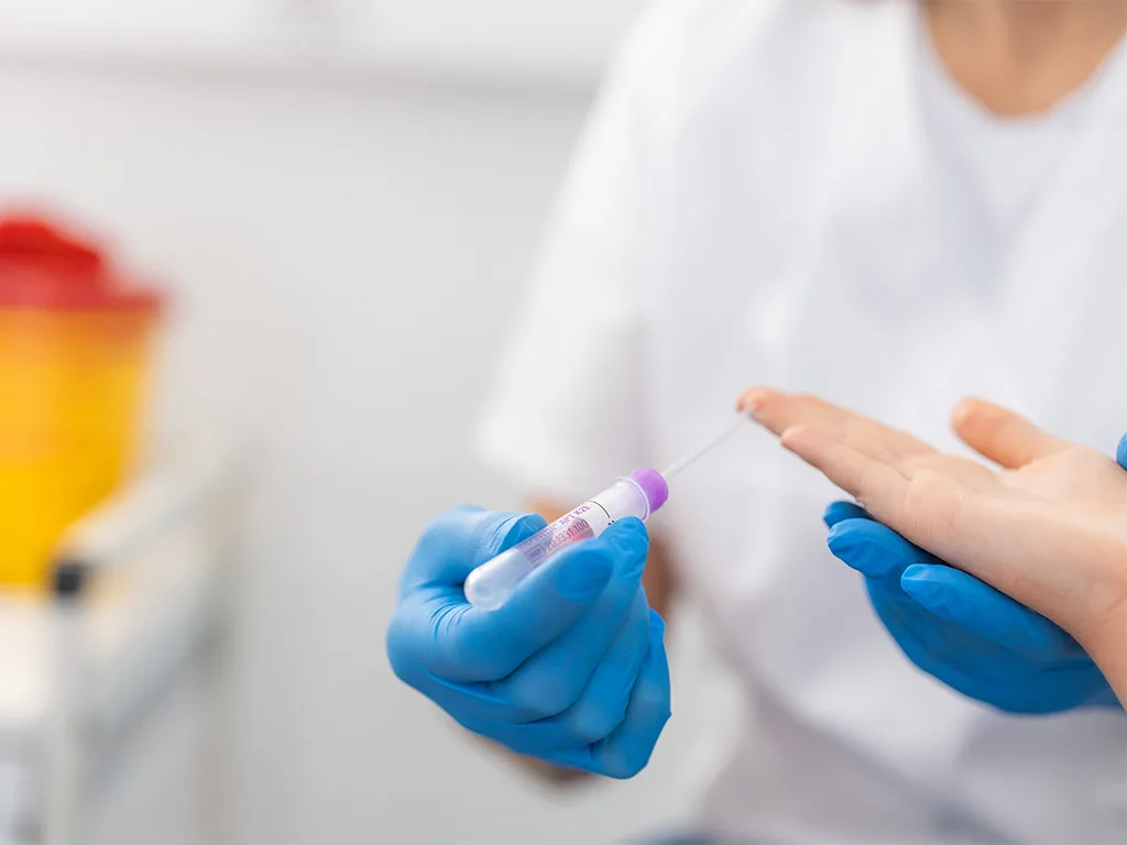 USE Probengewinnung Kapillare Blutentnahme RS314425 1024x768
