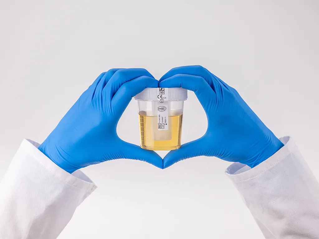 USE Probengewinnung Urin RS271151 1024x768