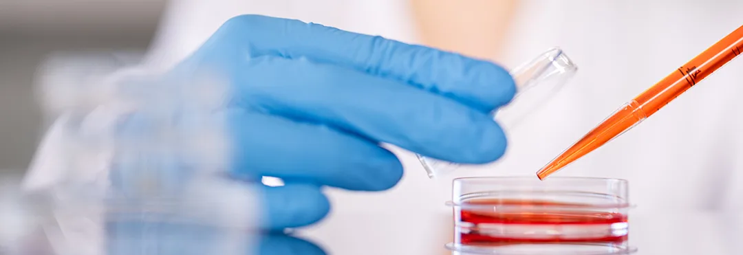 Cell culture dishes for the laboratory | SARSTEDT