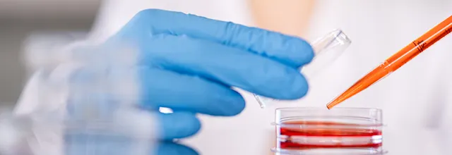 Cell culture dishes for the laboratory | SARSTEDT