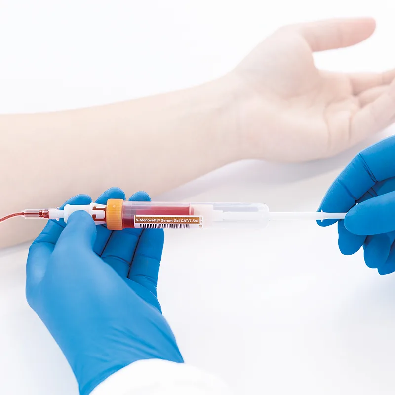 sar smt 800x800 blutentnahme