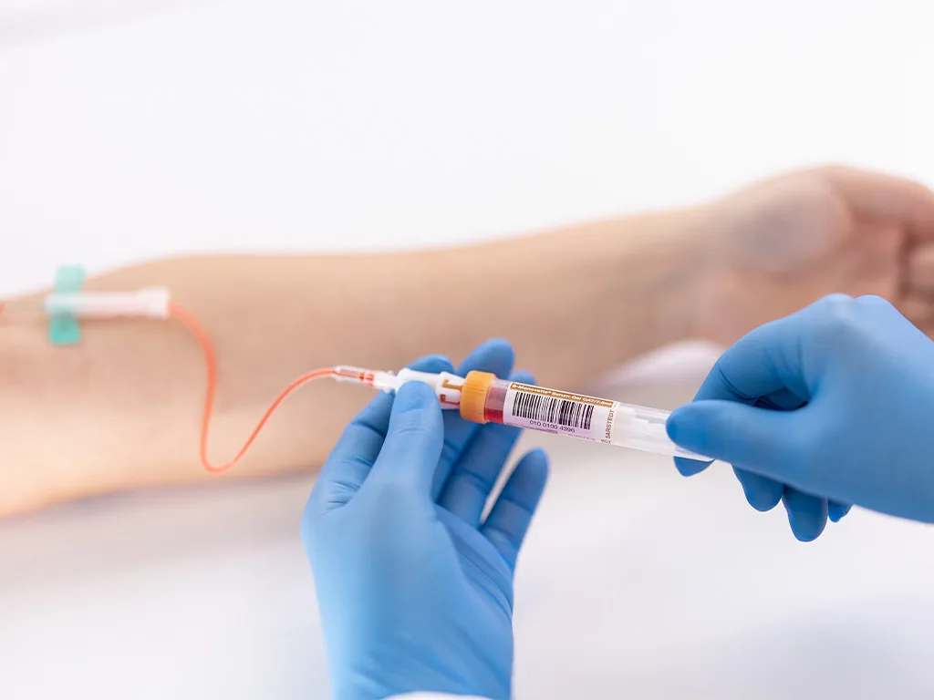 USE Probengewinnung Durchführung RS283392 1024x768