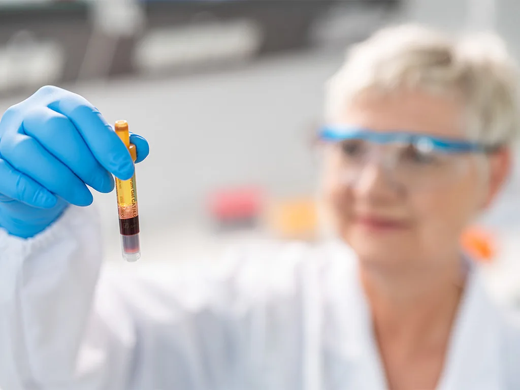 USE PA Kapillar Blutproben Allgemein RS314016 1024x768