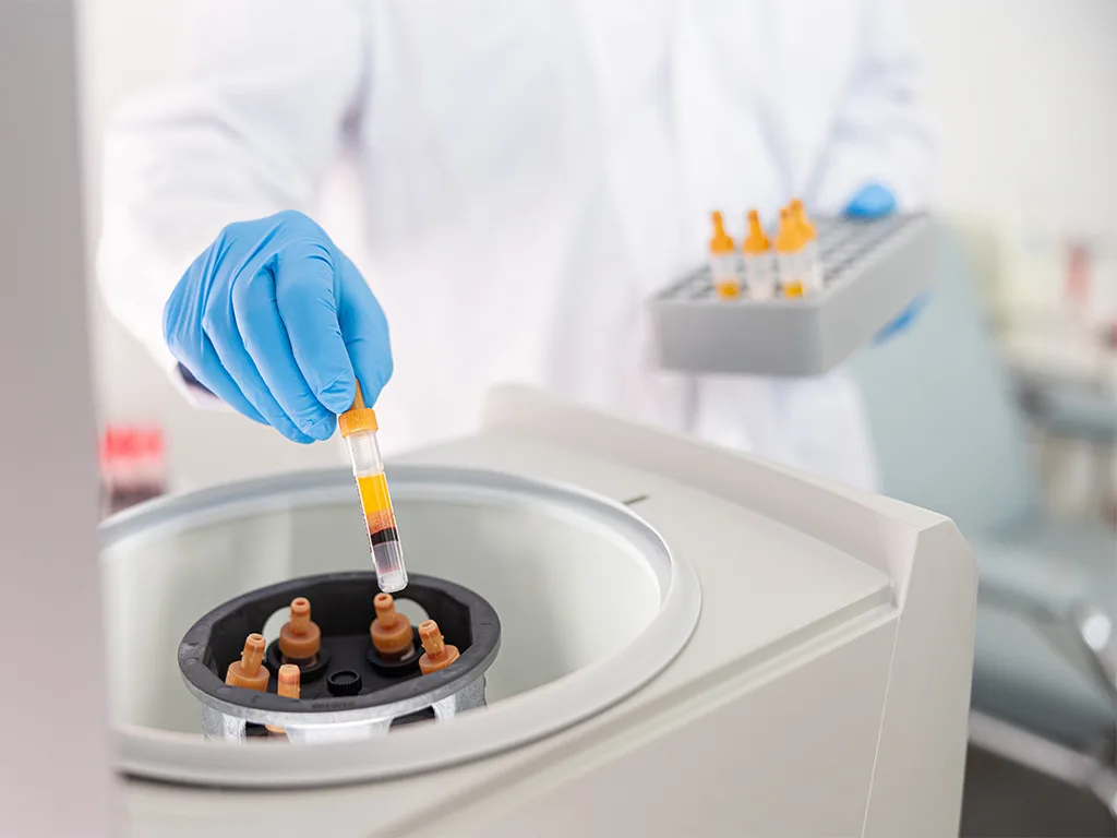 USE-PA-Präanalytischer-Workflow RS313994 1024x768