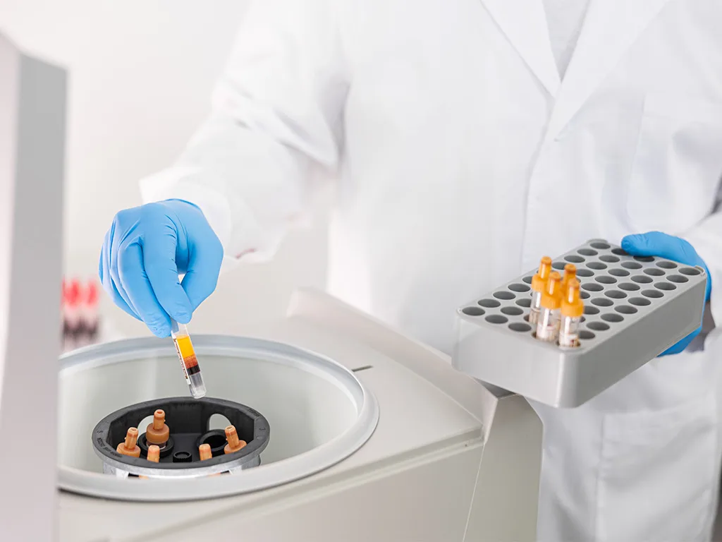 USE Probengewinnung Weiterverarbeitung VB RS314009 1024x768