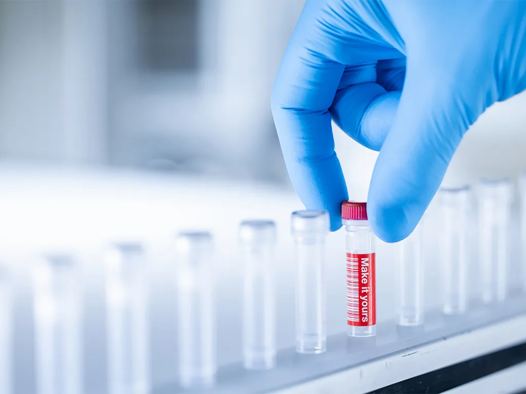 USE LS Probenhandling Unsere Mikro Schraubroehren RS303164 1024x768