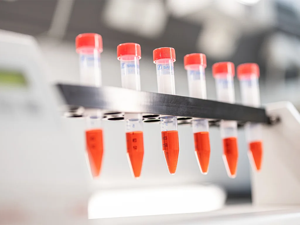 USE LS Probenhandling Handling RS314255 1024x768