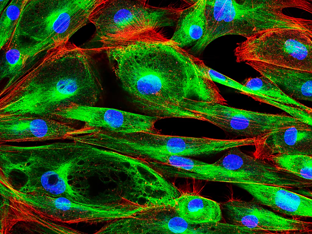 USE Fibroblastenzellen 117758099 1024x768