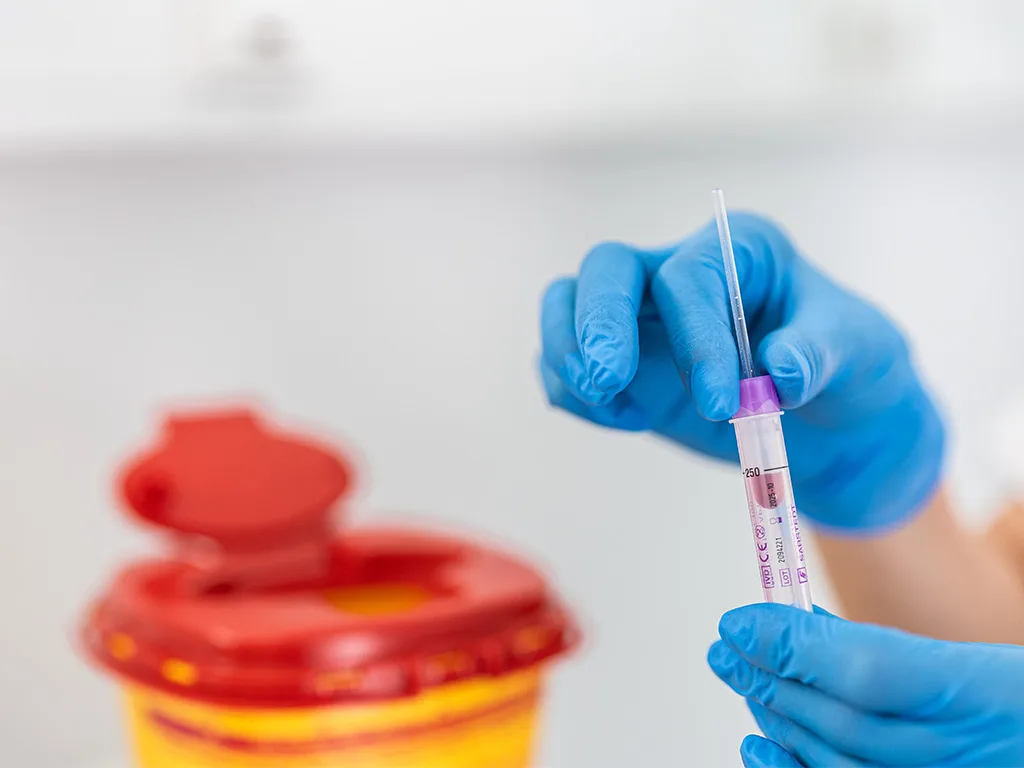 USE PA Kapillar Einleitung RS314449 1024x768