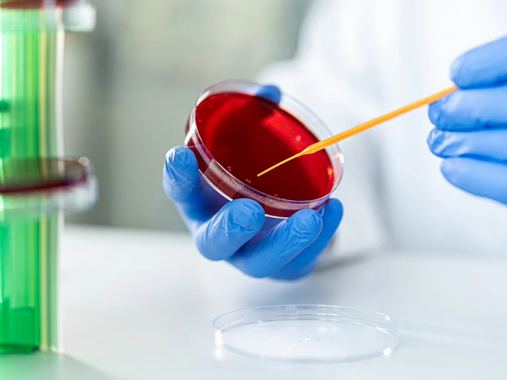 PRO-LA-Microbiology-Petrischale