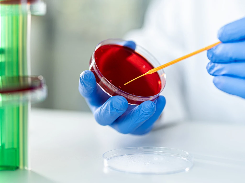PRO-LA-Microbiology-Petrischale