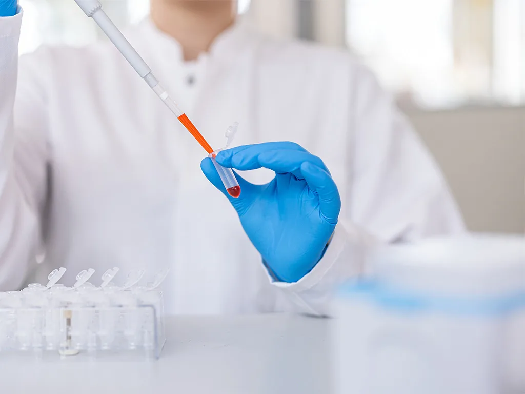 USE LS LiquidHandling Manuell vs Elektrisch RS314234 1024x768