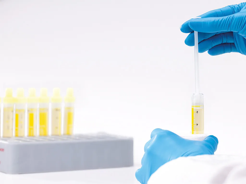 USE - PA - Urin - NFT Landingpage - Schritte Test - 1. Tropffreie Entnahme