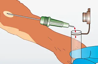 USE - VET - Tierisch schonend Landingpage - Die Micro-Kanüle mit Micro-Probengefäße oder Microvette® - Erfolgreich Abtropfen